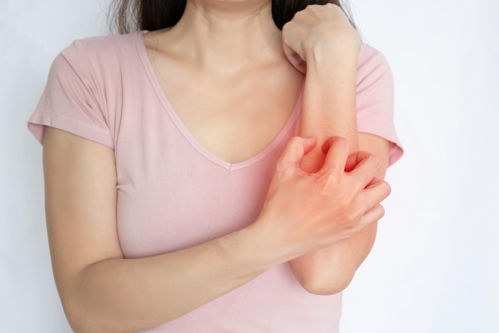 В Великобритании зафиксирован всплеск заболеваемости чесоткой